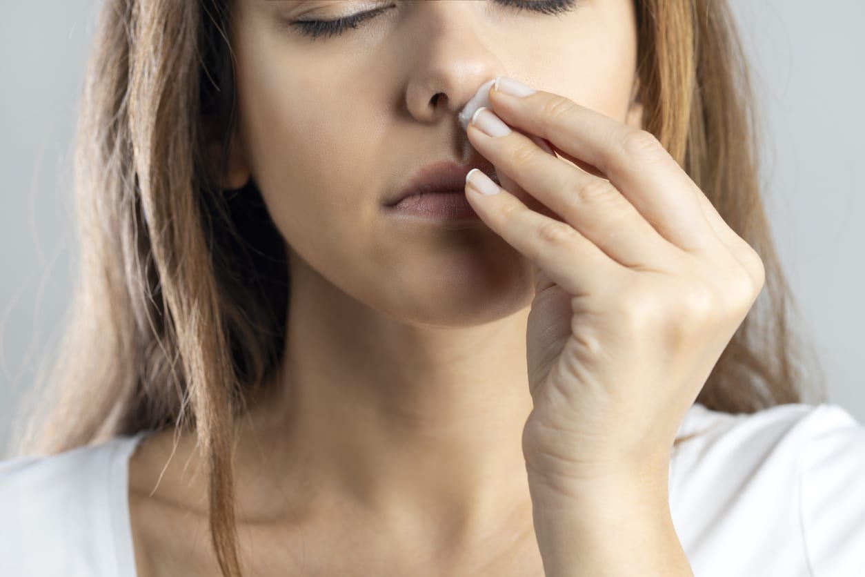 Woman holds tissue to nose indicating nosebleed
